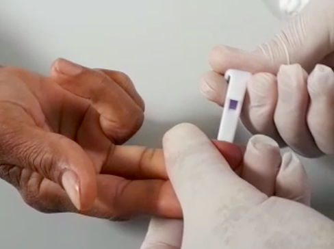 Prefeitura inicia aplicação de testes rápidos para o diagnóstico da Covid-19