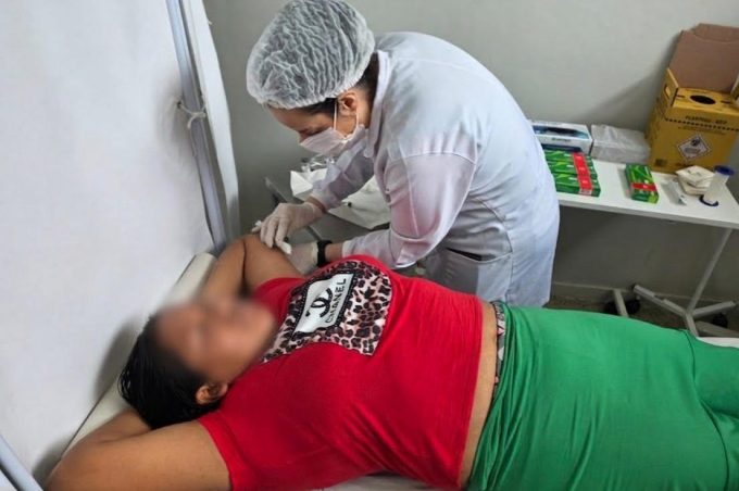 Ação no CAE II amplia acesso a implante contraceptivo para mulheres em situação de vulnerabilidade