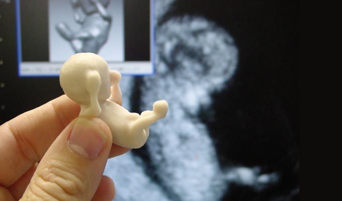 Governo Municipal garante ultrassom 3D para gestantes cegas